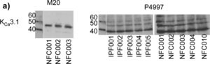 Merck ANTI-POTASSIUM CHANNEL KCA3.1