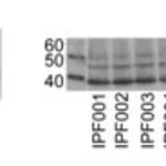 Merck ANTI-POTASSIUM CHANNEL KCA3.1