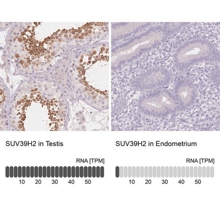 Merck Anti-SUV39H2 antibody produced in rabbit