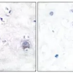 Merck ANTI-NOTCH 1 (CLEAVED-VAL1754)