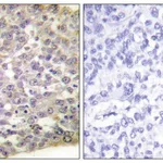 Merck Anti-14-3-3 zeta antibody produced in rabbit
