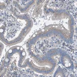Merck Anti-KIAA1024 antibody produced in rabbit