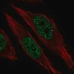 Merck Anti-RFX1 antibody produced in rabbit