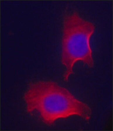 Merck Anti-RACK1 (N-terminal) antibody produced in rabbit