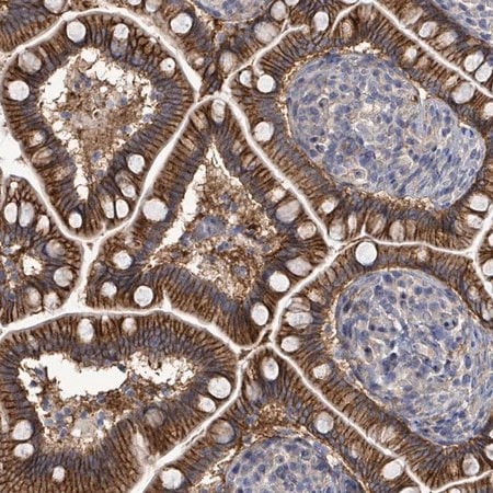 Merck Anti-KRAS antibody produced in rabbit