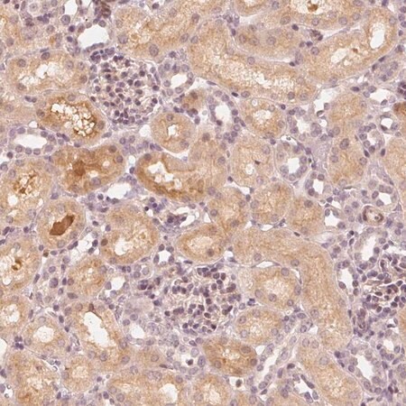Merck Anti-SLC34A1 antibody produced in rabbit
