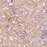 Merck Anti-SLC34A1 antibody produced in rabbit