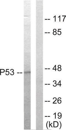 Merck Anti-p53 antibody produced in rabbit