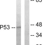 Merck Anti-p53 antibody produced in rabbit