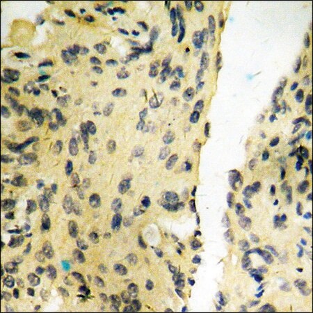 Merck Anti-phospho-Tyrosine Hydroxylase (pSer40) antibody produced in rabbit