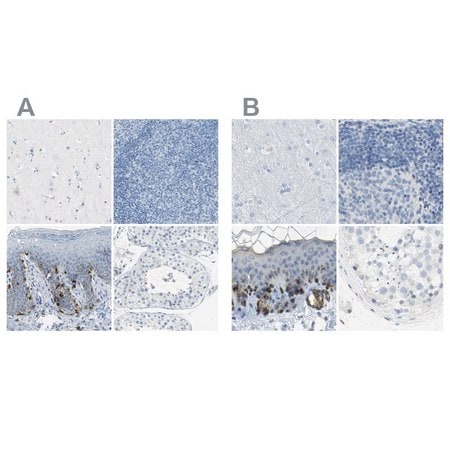 Merck Anti-DCT antibody produced in rabbit