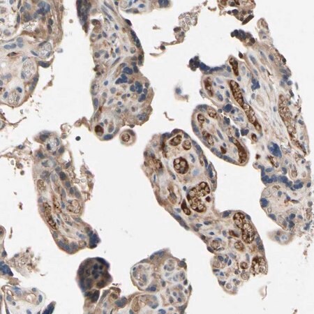 Merck Anti-IL1RL1 antibody produced in rabbit