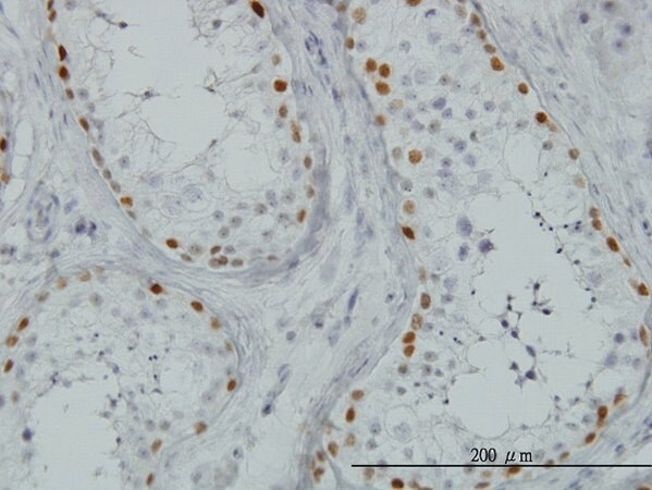 Merck Monoclonal Anti-SALL4 antibody produced in mouse