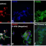 Thermo Fisher Scientific Goat anti-Mouse IgG1 Cross-Adsorbed Secondary Antibody, Alexa Fluor 594