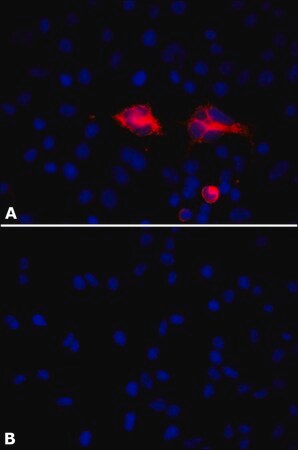 Merck Anti-PLAUR/uPAR antibody, Mouse monoclonal
