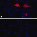 Merck Anti-PLAUR/uPAR antibody, Mouse monoclonal