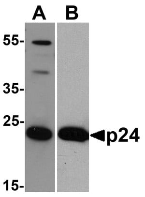 Merck Monoclonal Anti-HIV-1 p24 [8G9] Antibod&