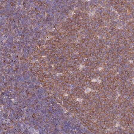 Merck Anti-NAMPT antibody produced in rabbit