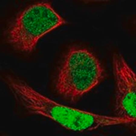 Merck Anti-NCAPG2 antibody produced in rabbit