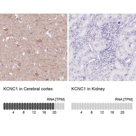Merck Anti-KCNC1 antibody produced in rabbit