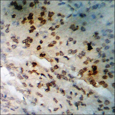 Merck Anti-phospho-BTK (pTyr223) antibody produced in rabbit