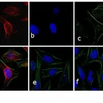Thermo Fisher Scientific Goat anti-Rabbit IgG (H+L) Cross-Adsorbed Secondary Antibody, APC