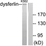 Merck Anti-Dysferlin, antibody produced in rabbit