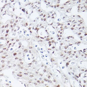 Merck Anti-Islet1 antibody produced in rabbit