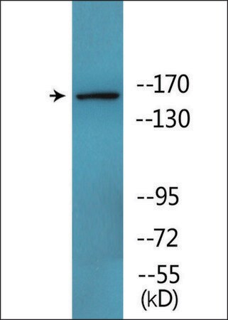 Merck Anti-phospho-Werner Syndrome Helicase (pSer1141) antibody produced in rabbit