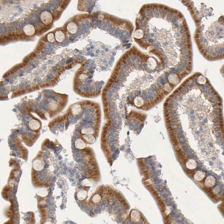 Merck Anti-MOGS antibody produced in rabbit