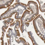 Merck Anti-MOGS antibody produced in rabbit
