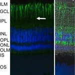 Merck MONOCLONAL ANTI-S-100 (B-SUBUNIT) CLONE&