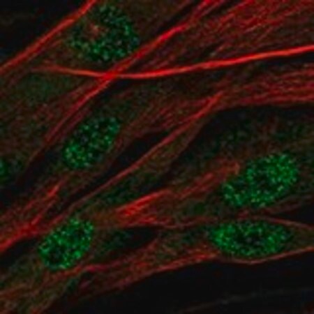 Merck Anti-ASPN antibody produced in rabbit