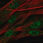 Merck Anti-ASPN antibody produced in rabbit