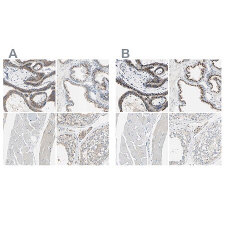 Merck Anti-B4GALT1 antibody produced in rabbit