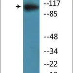 Merck Anti-phospho-MER/SKY (pTyr749/681) antibody produced in rabbit