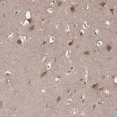 Merck Anti-LPCAT4 antibody produced in rabbit