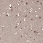 Merck Anti-LPCAT4 antibody produced in rabbit