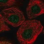 Merck Anti-ARPC2 antibody produced in rabbit