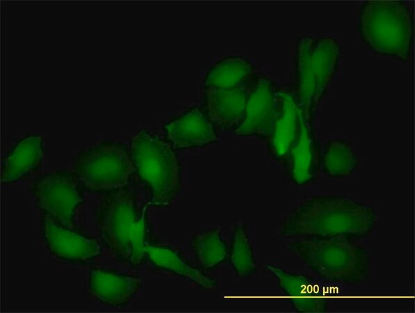 Merck Monoclonal Anti-LGALS1 antibody produced in mouse
