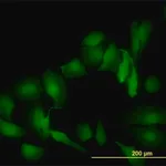 Merck Monoclonal Anti-LGALS1 antibody produced in mouse