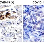 Merck Anti-SARS-CoV-2 (COVID-19) Spike RBD &