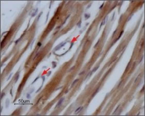 Merck Anti-Sodium Channel NaV1.5 antibody produced in rabbit
