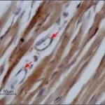 Merck Anti-Sodium Channel NaV1.5 antibody produced in rabbit
