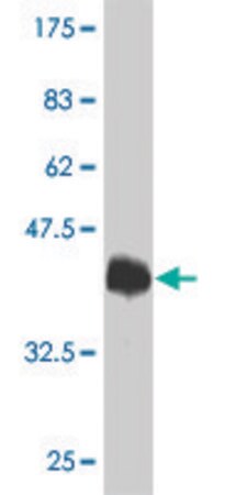 Merck Monoclonal Anti-TRPV1 antibody produced in mouse