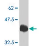 Merck Monoclonal Anti-TRPV1 antibody produced in mouse