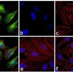 Thermo Fisher Scientific F(ab`)2-Goat anti-Rabbit IgG (H+L) Cross-Adsorbed Secondary Antibody, FITC