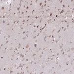 Merck Anti-APOLD1 antibody produced in rabbit