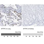 Merck Anti-SFTPC antibody produced in rabbit