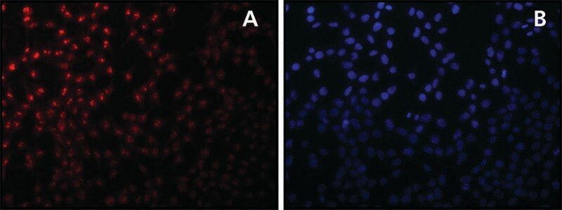Merck Anti-Sirt7 antibody produced in rabbit